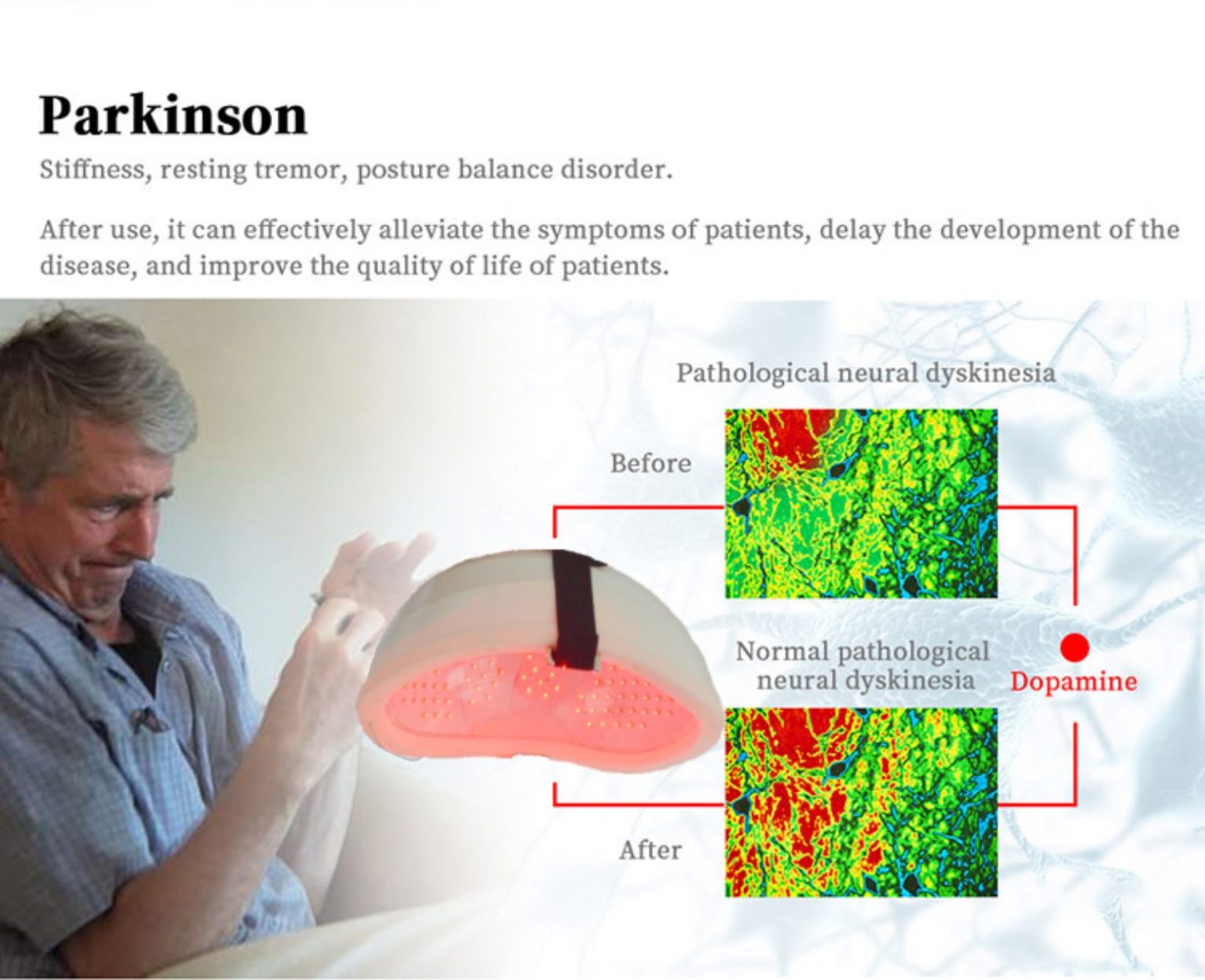 1.Cerebral arteriosclerosis Insufficient , blood supply to the brain 2.Brain atrophy 3.Alzheimer’s disease (AD) 4.Children with autism 5.Cerebral thrombosis, Cerebral 6.Lacunar infarction 7.Recovery of traumatic brain injury after operation 8.The recovery period after cerebral poisoning 9.Children with cerebral palsy 10.Parkinson’s disease 11.Depression 12.Mental disorders 13.Insomnia 14.Nervous headache 15.High blood pressure 16.Brain fatigue disease 17.Memory loss 18.Neurasthenia 19.Schizophrenia 1.Cerebral arteriosclerosis Insufficient , blood supply to the brain 2.Brain atrophy 3.Alzheimer’s disease (AD) 4.Children with autism 5.Cerebral thrombosis, Cerebral 6.Lacunar infarction 7.Recovery of traumatic brain injury after operation 8.The recovery period after cerebral poisoning 9.Children with cerebral palsy 10.Parkinson’s disease 11.Depression 12.Mental disorders 13.Insomnia 14.Nervous headache 15.High blood pressure 16.Brain fatigue disease 17.Memory loss 18.Neurasthenia 19.Schizophrenia