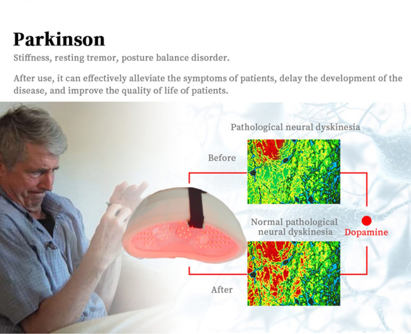 Alzheimer’s Save your brain and family Diseases that can be treated with the help of the Laser Helmet, Alzheimer’s disease , Brain Photobiomodulation Machine