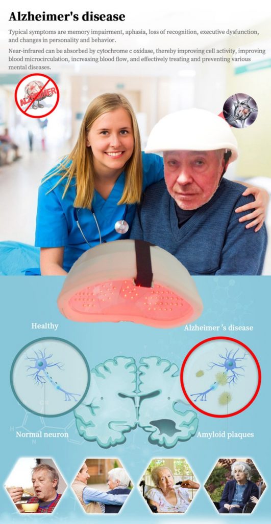 Alzheimer’s ,1.Cerebral arteriosclerosis Insufficient , blood supply to the brain 2.Brain atrophy 3.Alzheimer’s disease (AD) 4.Children with autism 5.Cerebral thrombosis, Cerebral 6.Lacunar infarction 7.Recovery of traumatic brain injury after operation 8.The recovery period after cerebral poisoning 9.Children with cerebral palsy 10.Parkinson’s disease 11.Depression 12.Mental disorders 13.Insomnia 14.Nervous headache 15.High blood pressure 16.Brain fatigue disease 17.Memory loss 18.Neurasthenia 19.Schizophrenia Alzheimer’s 1.Cerebral arteriosclerosis Insufficient , blood supply to the brain 2.Brain atrophy 3.Alzheimer’s disease (AD) 4.Children with autism 5.Cerebral thrombosis, Cerebral 6.Lacunar infarction 7.Recovery of traumatic brain injury after operation 8.The recovery period after cerebral poisoning 9.Children with cerebral palsy 10.Parkinson’s disease 11.Depression 12.Mental disorders 13.Insomnia 14.Nervous headache 15.High blood pressure 16.Brain fatigue disease 17.Memory loss 18.Neurasthenia 19.Schizophrenia
